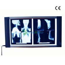 Medical Radiography X-ray Film Viewer